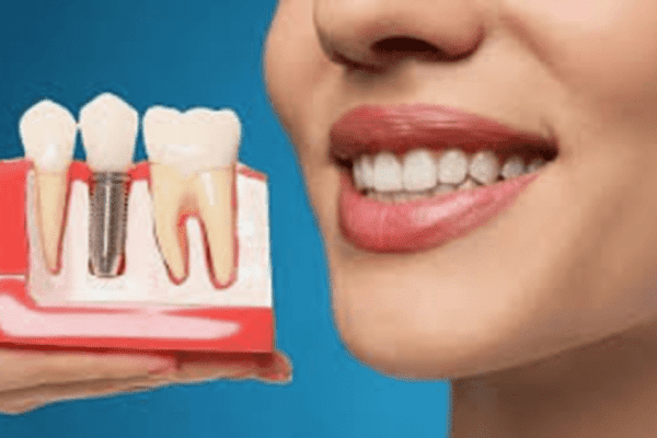 implant dentistry 112
